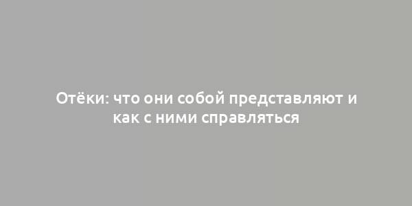 Отёки: что они собой представляют и как с ними справляться